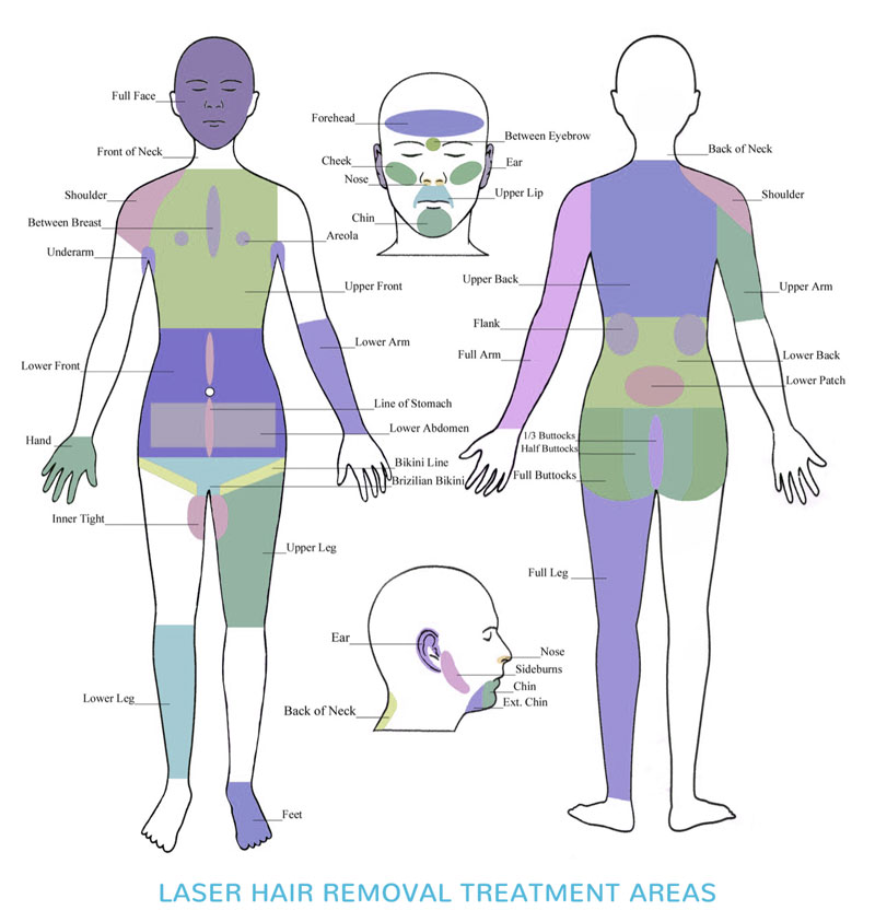 Laser Hair Removal